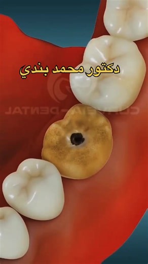 فيديوهات أنشأها Dr.Mohammed.Bandi (@dr.mohamed.bandi) باستخدام original sound - Dr.Mohammed.Bandi