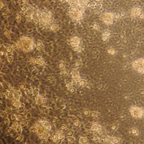 Video: Primary Microglia Isolation from Mixed Glial Cell Cultures of Neonatal Rat Brain Tissue