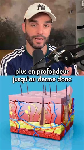 Comment on attrape un coup de soleil 🌞 | Dr Nozman