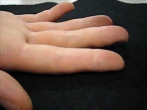 Moving Two Point Discrimination Test 2PD in Hand | Dr Junaid Ahmad Consultant Plastic Surgeon Lahore