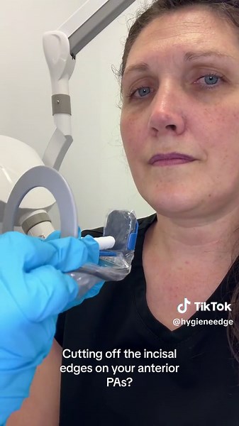 Have you cutting off the incisal edges with your PA radiographs? #dentalhygieniststudent #dentalhygieneproblems #rdh #dentistry #dentist #dentalhygienist