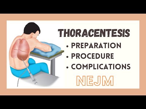 Thoracentesis - Preparation,l & Procedure Steps tutorial| NEJM | MS | BOARDS