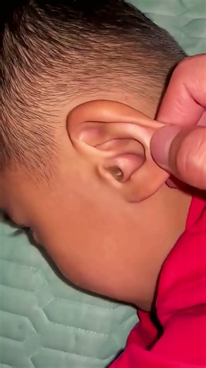 🔥Best Ear Cleaning Tool – Safe,Portable,Reusable Ear Cleaners for Adults Kids #3281 @sovorsgadget