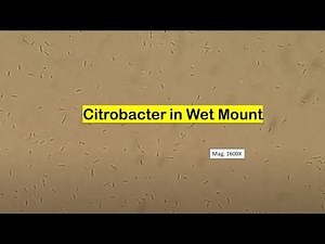 Citrobacter in Wet mount of Culture Microscopy