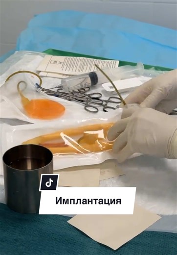 Understanding Penile Implants for Erectile Dysfunction