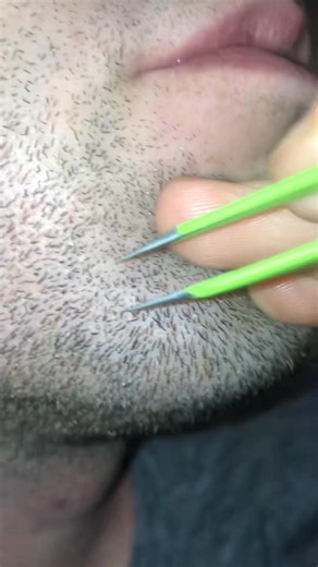 Pili multigemini #tweezers | PickyNiki