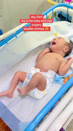 Bladder Exstrophy Surgery Update: Day 23 Progress