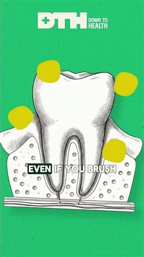Your teeth are in a daily battle: Remineralization vs Demineralization Who wins?
