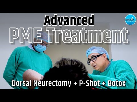 Advanced PME Treatments: Dorsal Neurectomy + P-Shot + Botox | Botox for Nightfall & S3X timing.