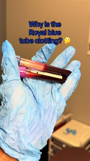 Understanding Royal Blue Tube Clotting in Phlebotomy