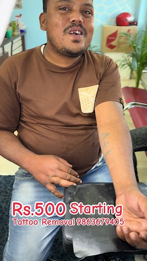 #tattooremoval #9815607821 #fyppppppppppppppppppppppp #foryoupageofficiall #fypシ゚