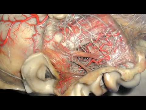 King's College London: Gordon Museum of Pathology