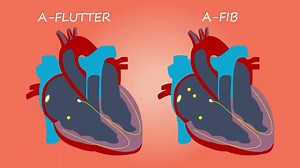 The Heart and Circulatory System - How They Work | Anatomy of the Heart | About Your Heart Attack |