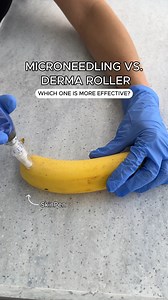 30K views · 77 reactions | Before you buy that derma roller, you're going to want to see this demo. ✨ Skip the at-home attempt and let us help rejuvenate your skin using the SkinPen. ​ Learn more here: https://bit.ly/4egnPwI | Ideal Image | Facebook
