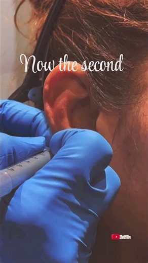 Pain or Pleasure? My Ear Piercing Experience Revealed #piercing #earpiercing #beauty #piercinglove