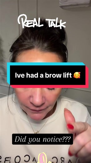 Brow Lift Journey: Over 50 and Fabulous