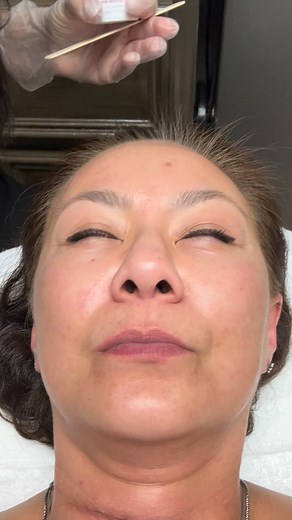 ✨ Brighten. Correct. Transform. ✨ If you struggle with melasma, stubborn dark spots, or uneven pigmentation, the Enlighten™ Depigmentation Peel is one of the most powerful solutions available. 🌤️ This advanced medical-grade peel targets deep pigment at the cellular level, helping break up discoloration while revealing a brighter, more even, radiant complexion. 💫 ✔️ Reduces melasma ✔️ Fades dark spots post-inflammatory hyperpigmentation ✔️ Smooths texture ✔️ Reveals a luminous, glass-skin glow 