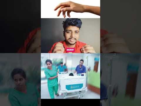 Rare Alien Hand Syndrome 😳 This is not horror movie script This is a Disease 🫢