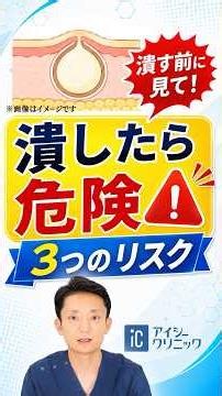 「ニキビかも？」で潰すと危険な「粉瘤」｜医師が正しい対処を解説 #粉瘤 #ニキビケア
