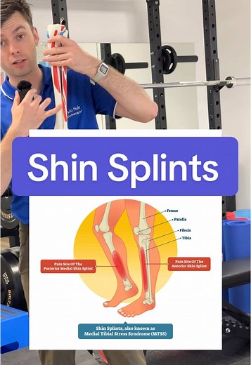Understanding Shin Splints: Causes and Remedies
