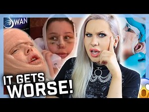 The Swan Season 1 (Full Episode Reaction) Plastic Surgery Supercut! ‪@Luxeria‬