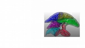 A Novel Surgical Technique As a Foundation for In Vivo Partial Liver Engineering in Rat