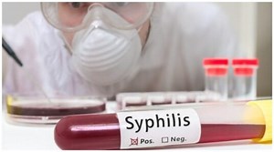 Syphilis and Congenital Syphilis Cases Are on the Rise in US