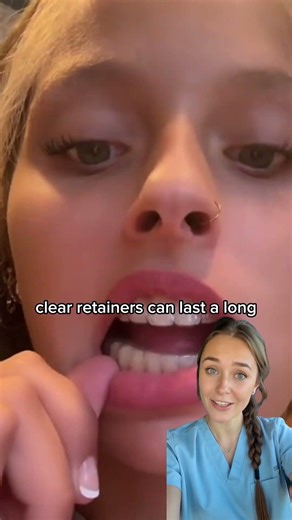 How much are clear retainers?