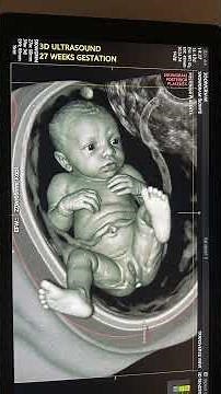 Week 27 Pregnancy: Baby Movements & Growth in 3D