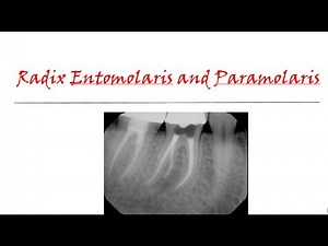 Radix entomolaris and paramolaris