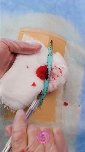 Beinschmerzen Ade: Die Geheimnisse hinter Krampfadern enthüllt! 🌟🦵