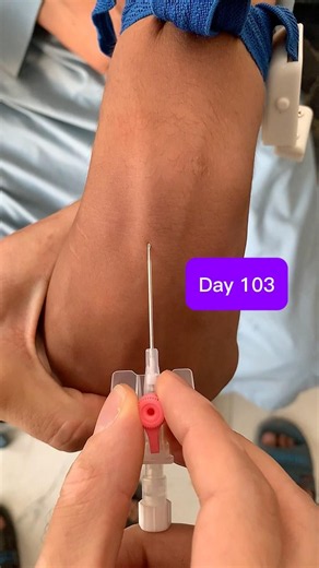 Day 103: Large Vein IV Cannulation Technique (Pink 20G) 💉🩺 #Shorts#safai#safi#nurseryrhymes