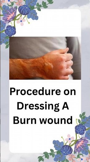 Dressing A Burn Wound procedure