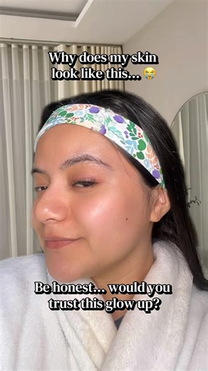 Why does my skin look like this… ￼#glowup#glowyskin#hydration#moisturizer#skincareroutine