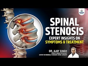 Understanding Spinal Stenosis: Causes, Symptoms & Advanced Treatment Options