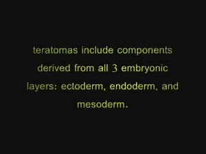 TERATOMAS