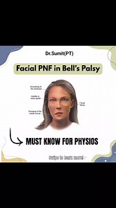 FACIAL PNF IN BELL'S PALSY #physiotherapy_world #physicaltherapy #physio #physiotherapist #Physiotherapie #physiotherapy | Dr. Sumit PT