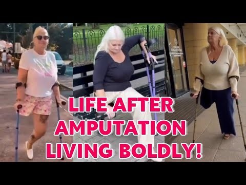 Amputee woman adaptive crutches user | exploring life after amputation