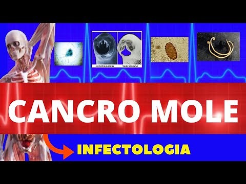CANCRO MOLE - CAUSAS, SINTOMAS, DIAGNÓSTICO E TRATAMENTO - INFECTOLOGIA