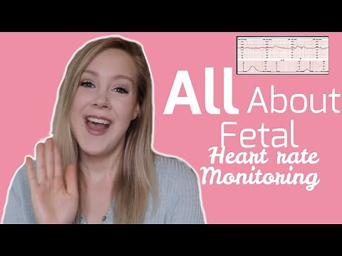 Understanding Fetal Heart Rate Monitoring || Terminology, NSTs, and MORE!