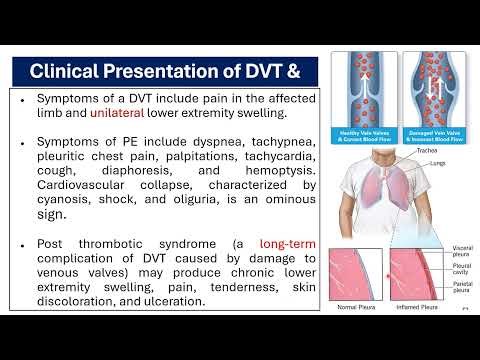 Lecture 6 Critical care 2026