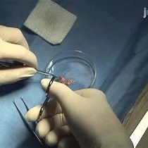 Video: Mouse Model of Surgically-induced Endometriosis by Auto-transplantation of Uterine Tissue