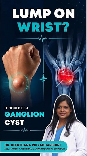 Found a Lump on Your Wrist? It Could Be a Ganglion Cyst | Dr Keerthana