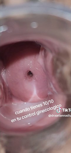 Tener un adecuado control con tu #ginecologo te hará tener un #cuellouterinosano
