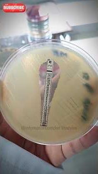 E-test Explained: Determining MIC with Polymyxin (PO) 🔬 | #Microbiology #Antibiotics #Shorts