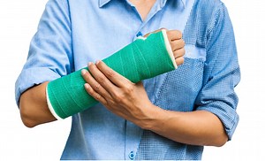 Plaster Cast Application - Fracture Info