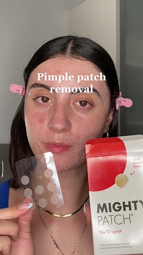 Hero Mighty Patch: Acne Spot Treatment & Skin Care Routine
