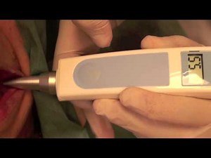 Testing the stability of CeraRoot implants with Periotest M