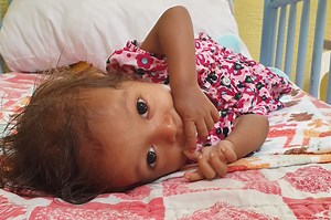 Rescue a Malnourished Child in Guatemala