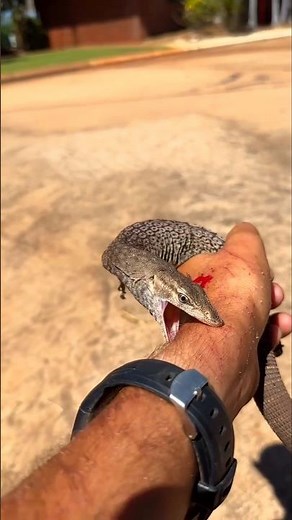 What happens if a lizard bites you? #shorts #lizard #facts